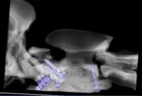 poppy surgical fix